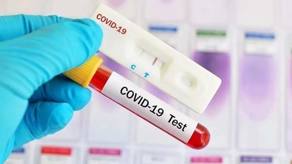 В Челябинской области 167 человек заболели коронавирусом за день