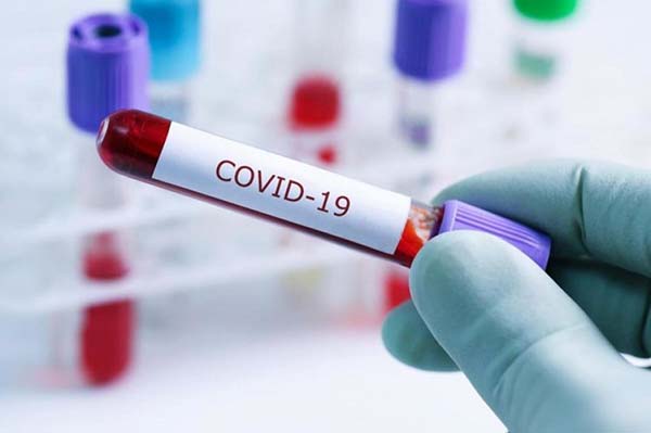 В Челябинской области 101 человек заболел коронавирусом за сутки